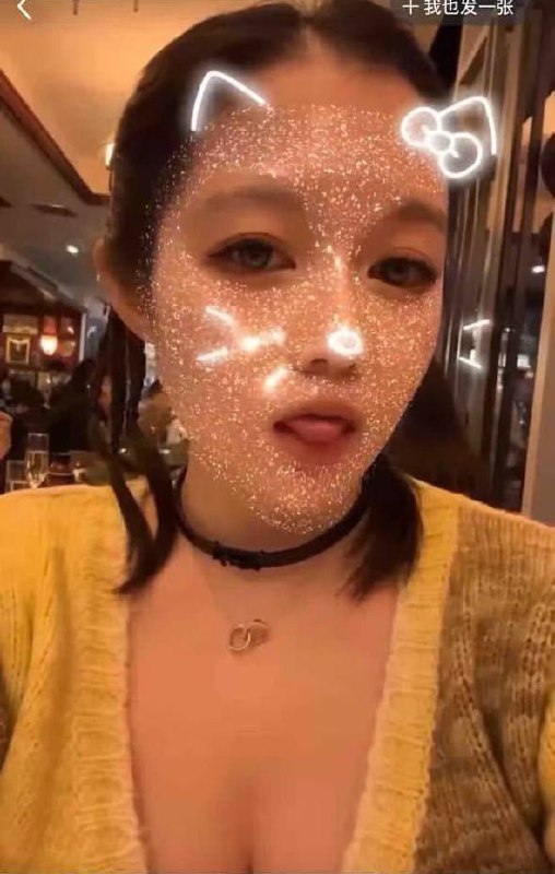 #董袭莹 中日友好医院肖飞与护士长董袭莹婚外情连环瓜中日友好医院胸外科副主任医师肖飞，顶着北京大学外科学博士、梅奥诊所访问学者的光环，凭借单孔胸腔镜领域上千例手术经验成为行业标杆