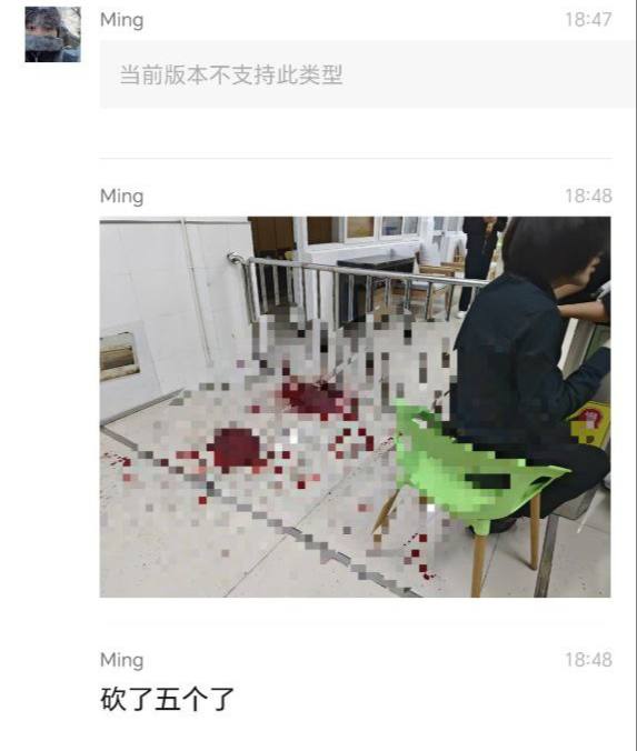 #江苏无锡 #无锡工艺职业技术学院 无锡工艺职业技术学院持刀伤人事件